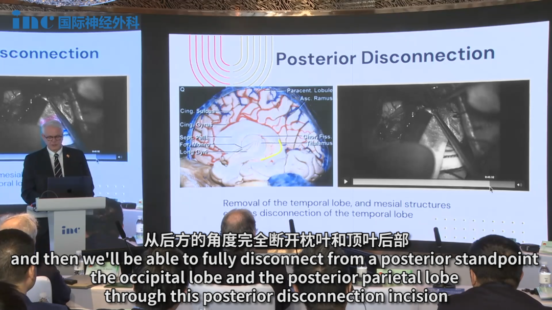 这里是后部的断开点，可以沿着大脑镰达到小脑幕。如果沿着大脑镰走，会发现大脑镰起着指引的作用。