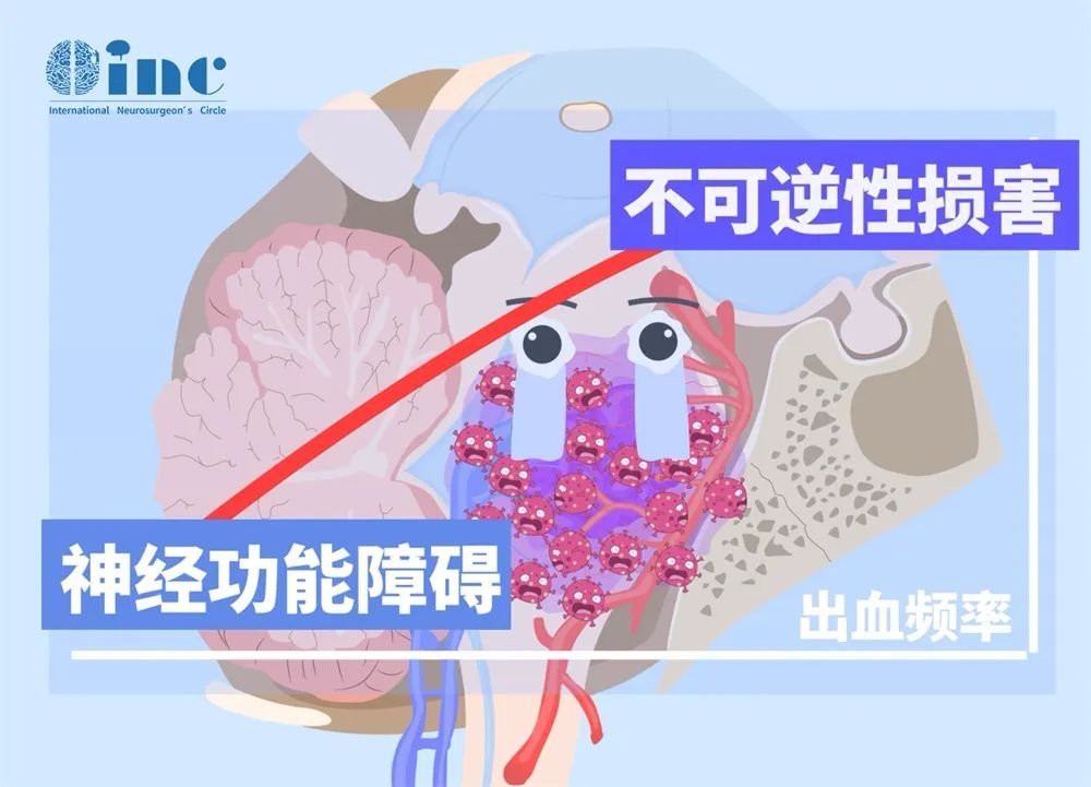但是等待，正如有时会被许多医生推荐的那样，并不好，因为经过长期的等待，在最初的一次出血之后，会形成一个局部疤痕，而这个疤痕的形成实际上阻碍了一个好的手术，这使得手术更困难，更危险，甚至有时阻碍完全切除病变。