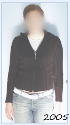 10年前他们说，手术没有意义，她没有机会了。病灶位于脑干，可能是间变性星形细胞瘤，甚至是更高级别肿瘤。