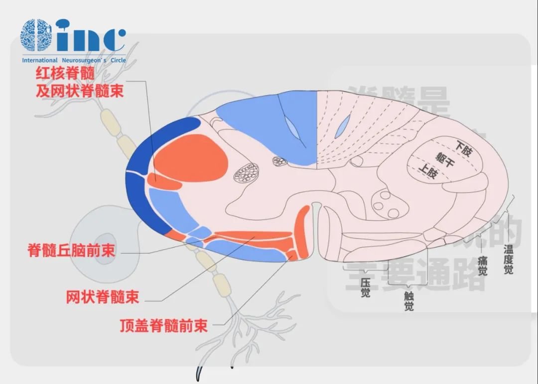脊髓肿瘤分型有哪些？INC国际施罗德教授治疗实例分享