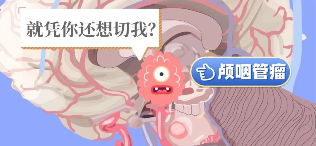 巴教授天坛医院颅咽管瘤手术纪实