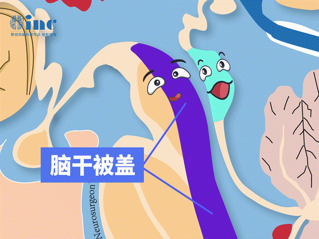 脑干被盖