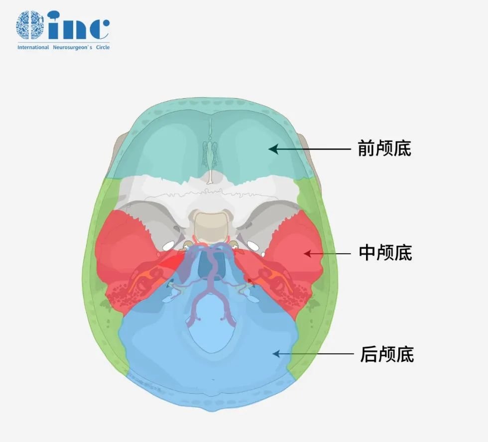 【国际儿童脑瘤大咖Rutka】盘点儿童颅底各大病变系列五：胆脂瘤