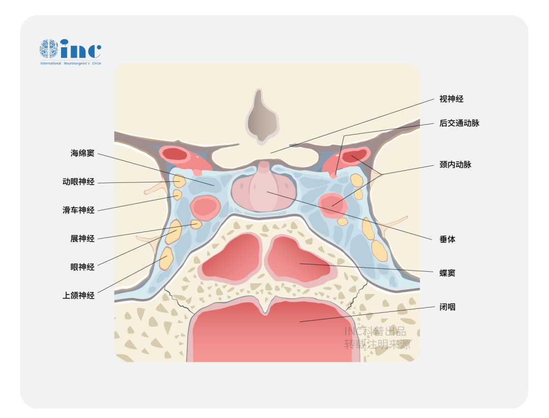 你听说过NF1儿童视神经胶质瘤吗？这种情况怎么治...