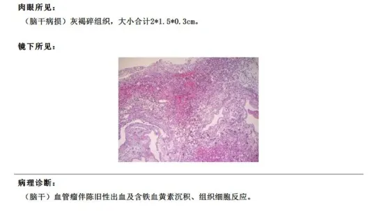 术后病理结果
