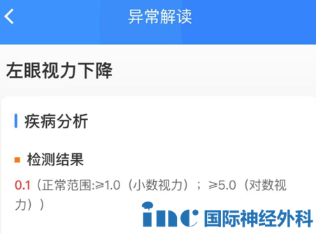 她的左眼视力降到了十分微弱的0.1，仅为正常视力的10%，已经严重影响到了她的日常生活。