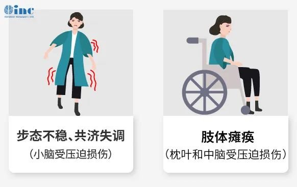 症状