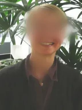 图：患者功能均很好，无面瘫、肢体瘫痪等，工作和生活如常