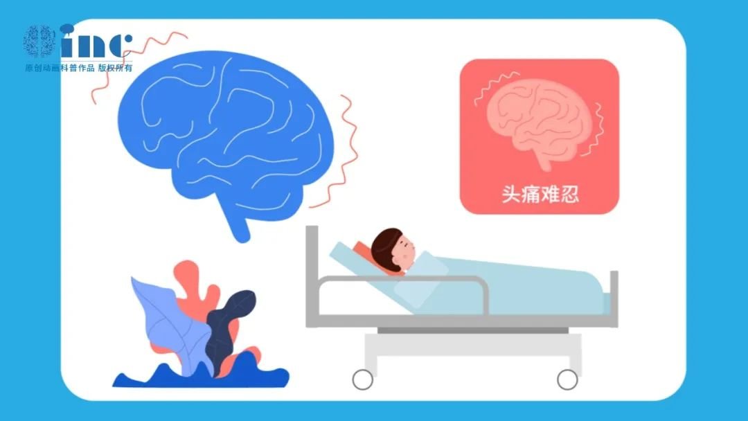 儿童反复头痛、还可能智力下降！脑血管病-烟雾病的“无奈和痛楚”