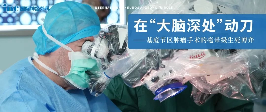 早在2002年，INC巴特朗菲教授发表了他的成功手术成果和经验 ，证明即使是位于脑干、基底节区和丘脑等关键部位病变，也是可以安全地尽全切除，效果良好，发病率低。教授在这篇论文中写到：在20世纪80年代后半期接受手术的患者，当时世界范围内几乎没有脑干、丘脑、基底神经节等此类病变的经验，具有重大意义！