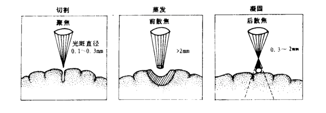 激光对脑组织的热效应