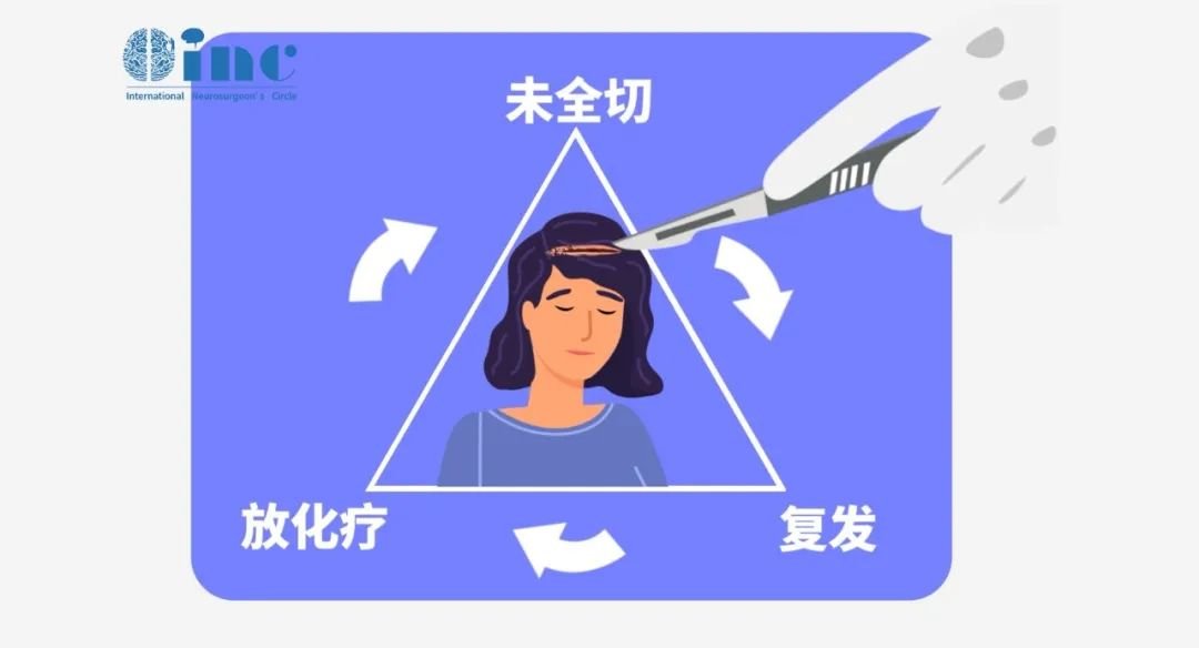 肿瘤复发