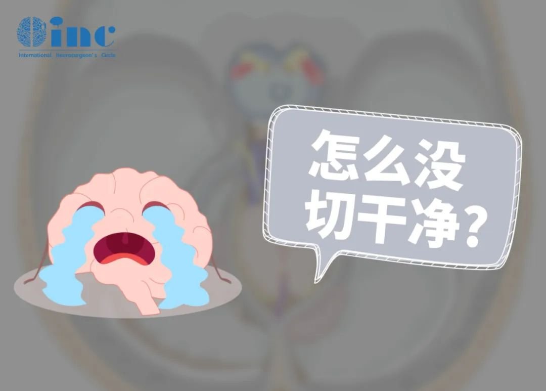 手术时并没有进行完全切除