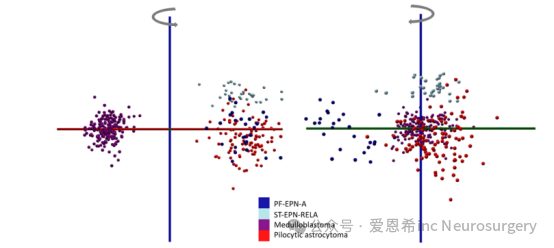 图2. 基于表1中18种已鉴定代谢物的稀疏PCA-LDA模型。该模型采用稀疏(或低复杂度)的PCA-LDA建模方法(使用AMX6.18)，与图S2中使用m/z 100−1000范围内所有m/z特征不同，此处仅利用表1中完全鉴定的代谢物阵列。在此，多变量模型仅基于表1中确定并报告的18种特征的分子身份进行同步降维构建。我们展示了模型的两个视图(围绕LD3轴，蓝色轴旋转)。LD1和LD2轴分别以红色和绿色显示。