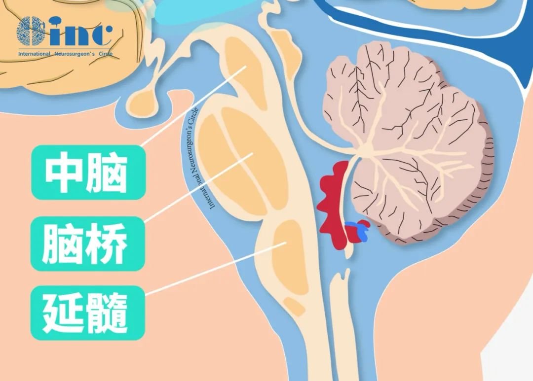 中脑位置示意