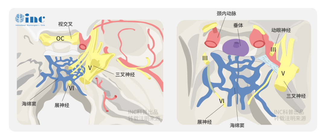 岩斜区脑膜瘤仍然是神经外科医生面临的一个巨大挑战。
