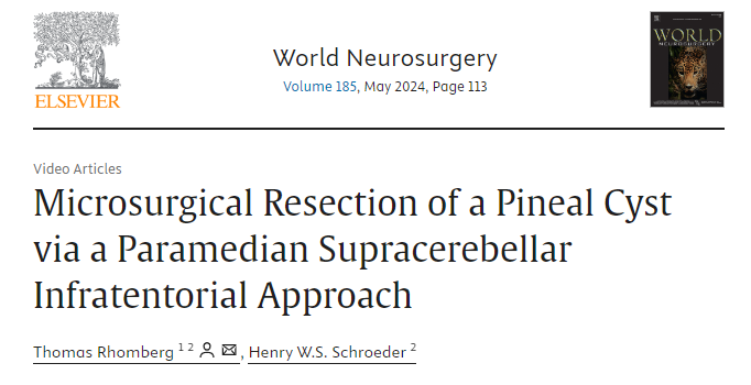 施罗德教授所发表的论文《Microsurgical Resection of a Pineal Cyst via a Paramedian Supracerebellar Infratentorial Approach》(通过旁中线幕下小脑上入路显微手术切除松果体囊肿)