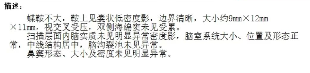 2024年开始，又开始出现视力下降，视野缺损。眼科检查发现，左眼视力为0.05.右眼视力为0.3.