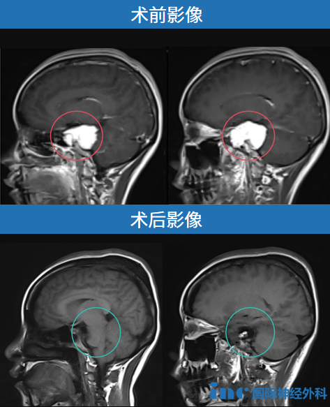 影像对比