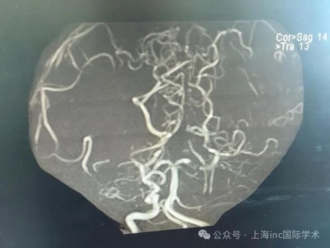 环境和病理生理因素