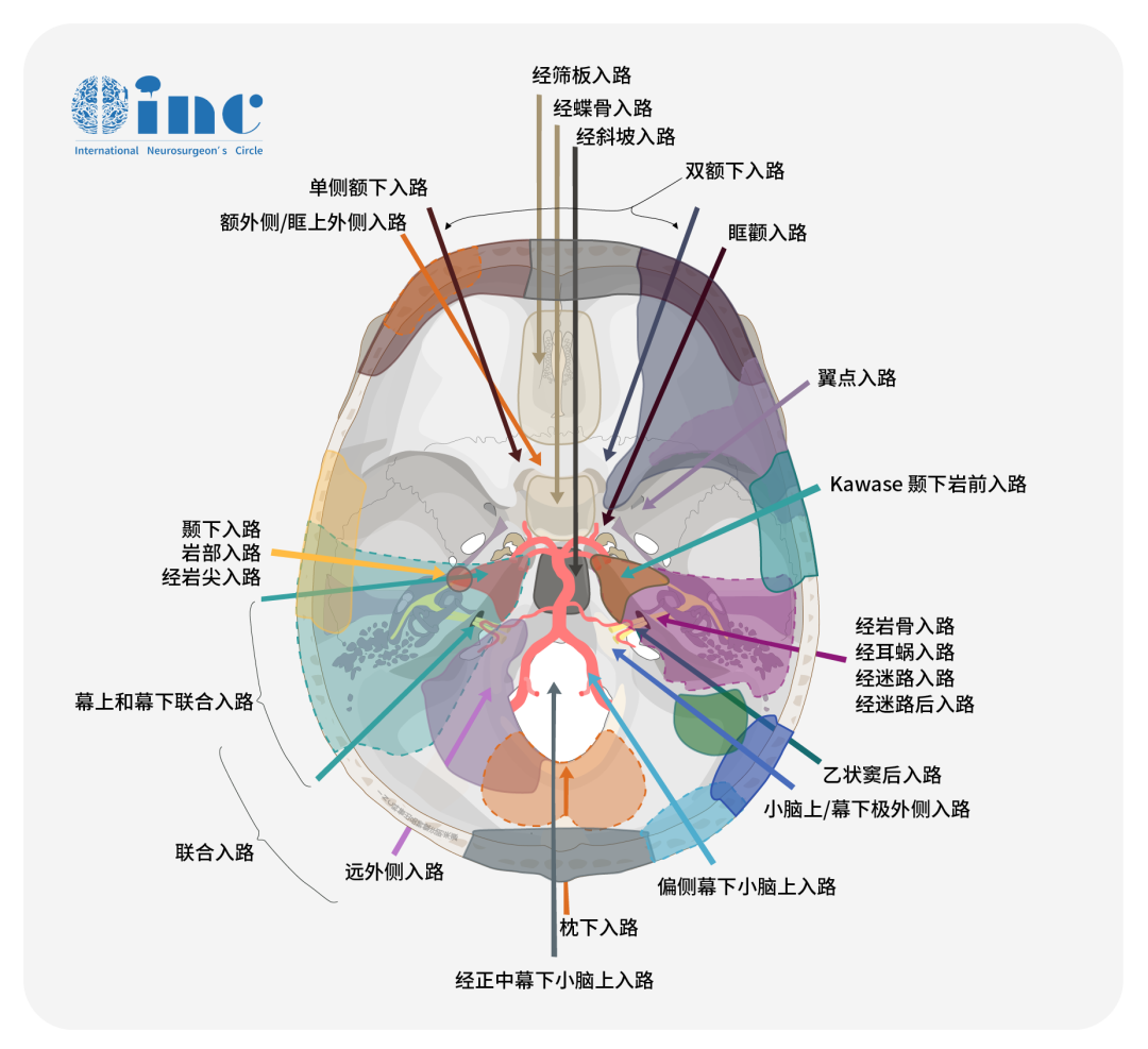 不同解剖位置的动脉瘤所适用的手术入路