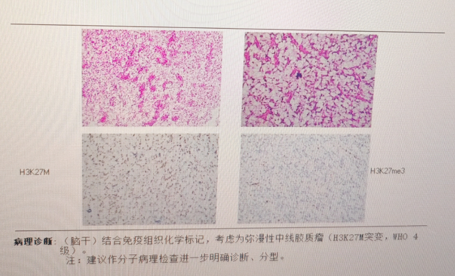 病理诊断