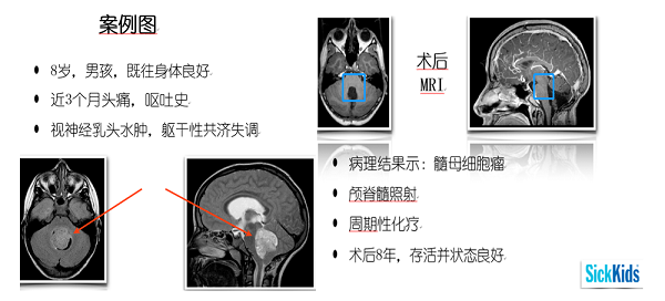 Noah对该治疗方案耐受良好