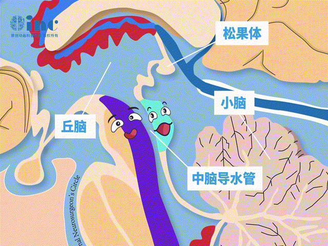 中脑导水管
