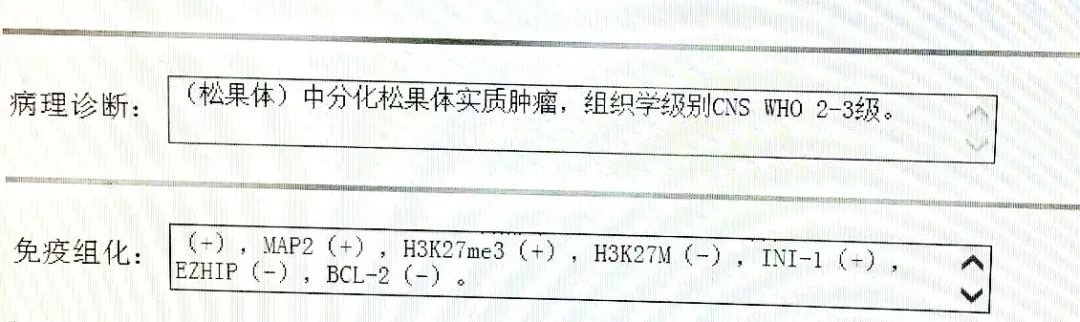 病理诊断