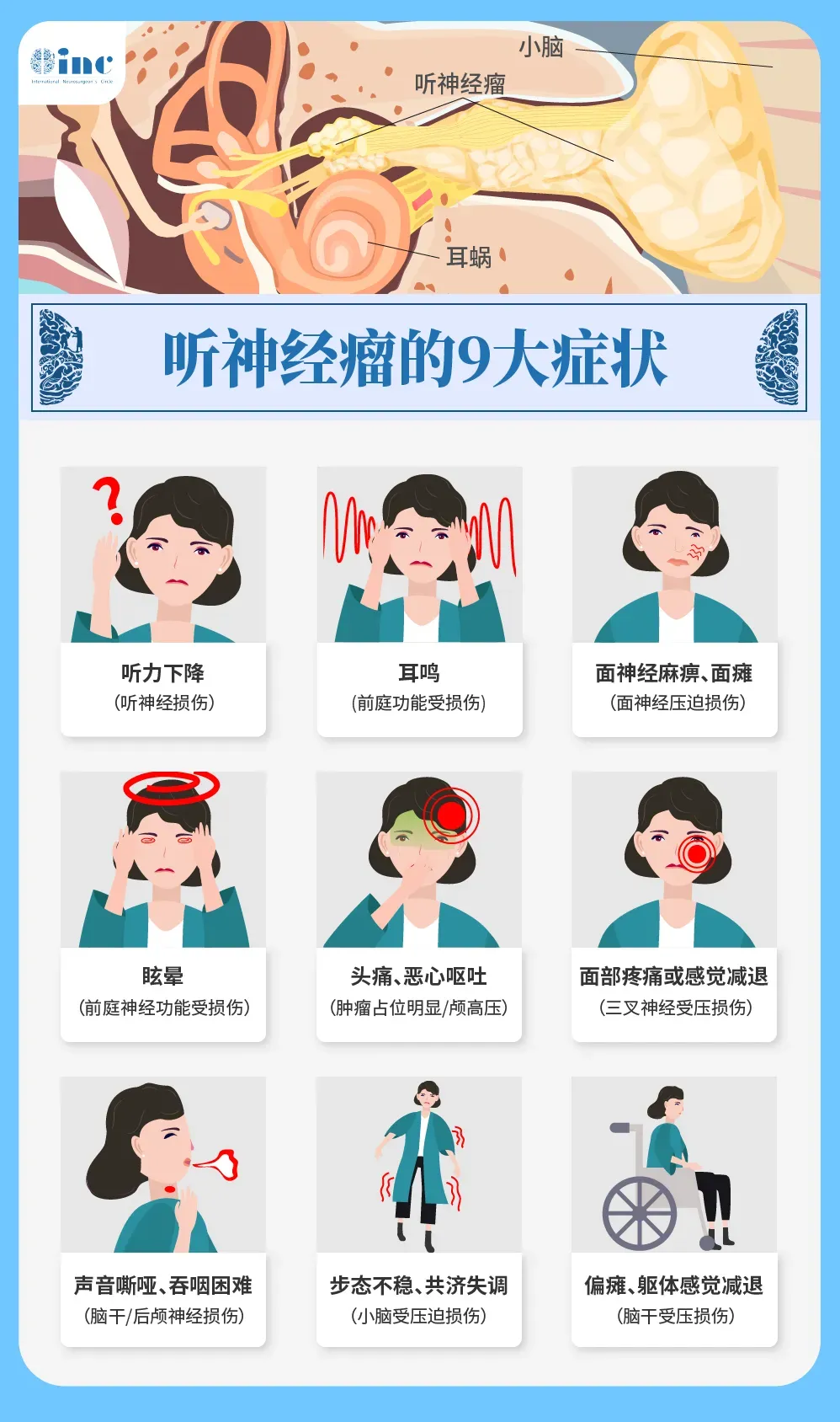 听神经瘤的九大症状