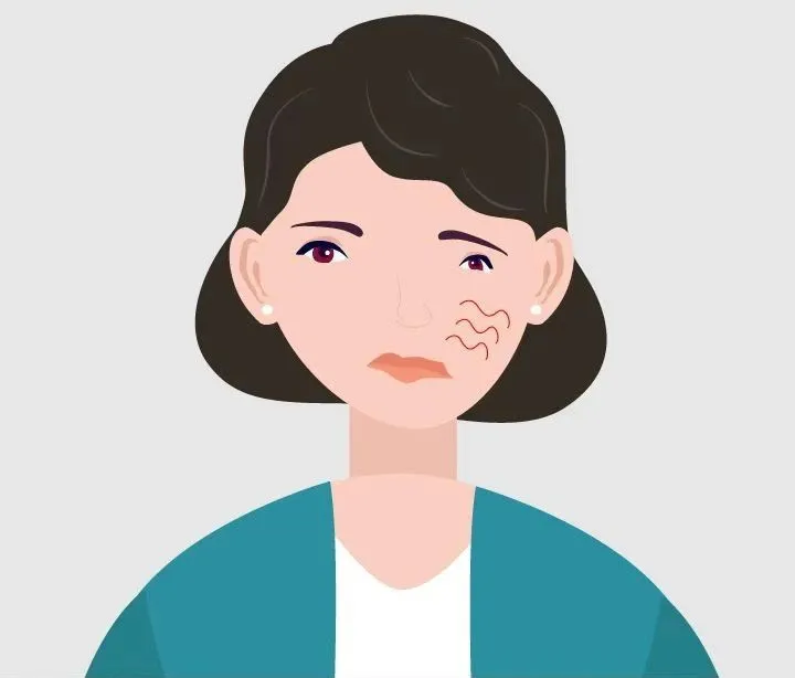 24岁女孩面肌痉挛已经持续了九年