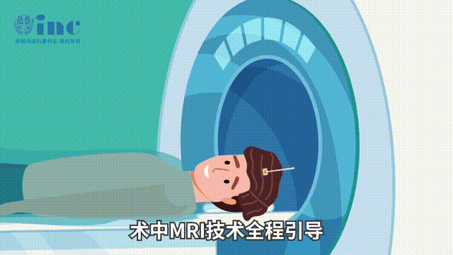 激光间质热疗（LITT）为何能达到如此效果？