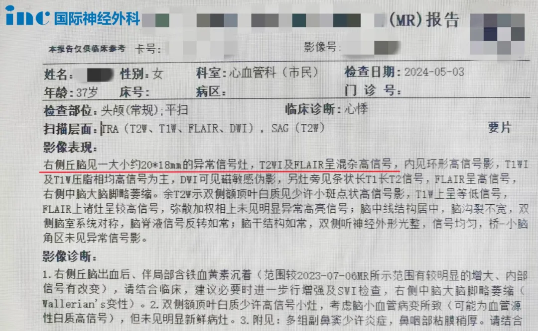 右侧丘脑见一大小约20*18mm的异常信号灶，T2WI及FLAIR呈混杂高信号