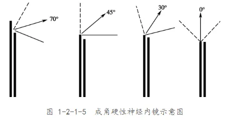 成角硬性神经内镜示意图