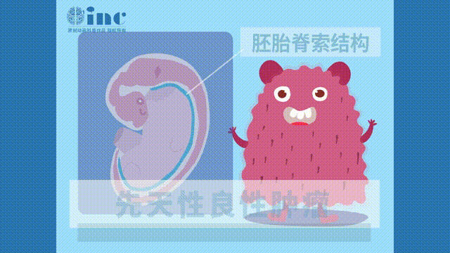 经鼻入路切除巨大脊索瘤：福教授天坛医院手术纪实