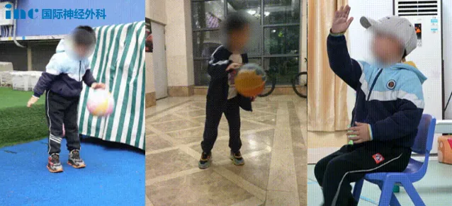 从“<a href='/naoliu/' target='_blank'><u>脑瘤</u></a>患儿”  到“篮球小子”