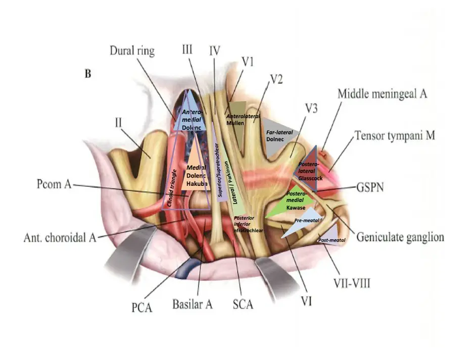注：图Practical-Handbook-of-Neurosurgery-From-Leading-Neurosurgeons，改良后