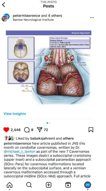 图 5. Instagram 的帖子合作功能允许同时在作者和合作者的个人资料上发布，以扩大影响力。图中展示了《神经外科杂志》（JNS）和 Peter Lawrence 之间的一个合作示例。