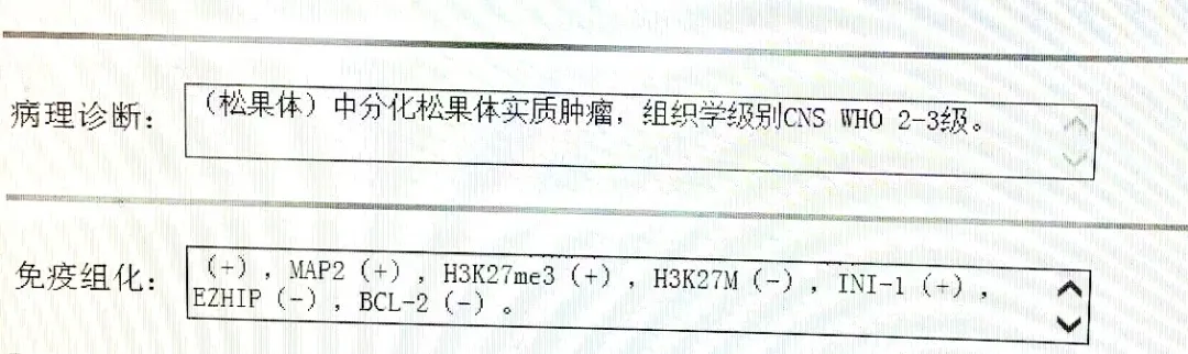 一周后的病理结果让喜悦蒙上了一层复杂的庆幸：中分化松果体实质肿瘤，WHO 2-3级（中度恶性）