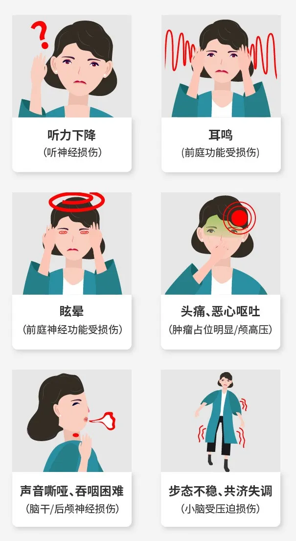 并非所有耳鸣都是由听神经瘤引起的，因为听神经瘤往往还伴随着听力下降、眩晕等症状。