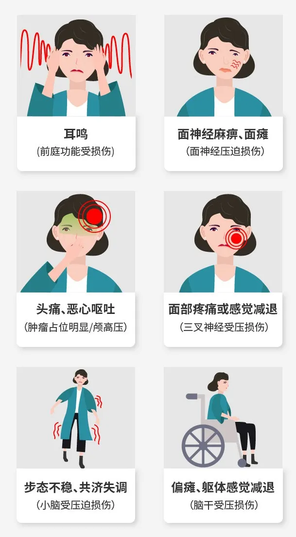 耳鸣是听神经瘤常见的临床表现，约占70%