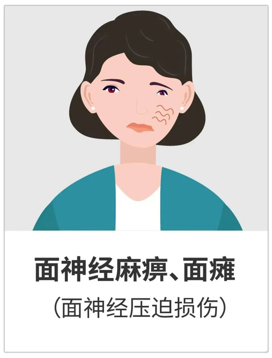 肿瘤囊性部分的快速增大或瘤内出血，这就可能是导致手术前就出现面瘫；也有少数病人会感觉脸抽筋，或者出现类似面肌痉挛的症状。