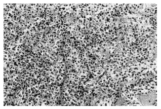 组织切片显微照片（HE染色，×200）。典型窦隙状（sinusoidal）垂体腺瘤结构清晰可见。