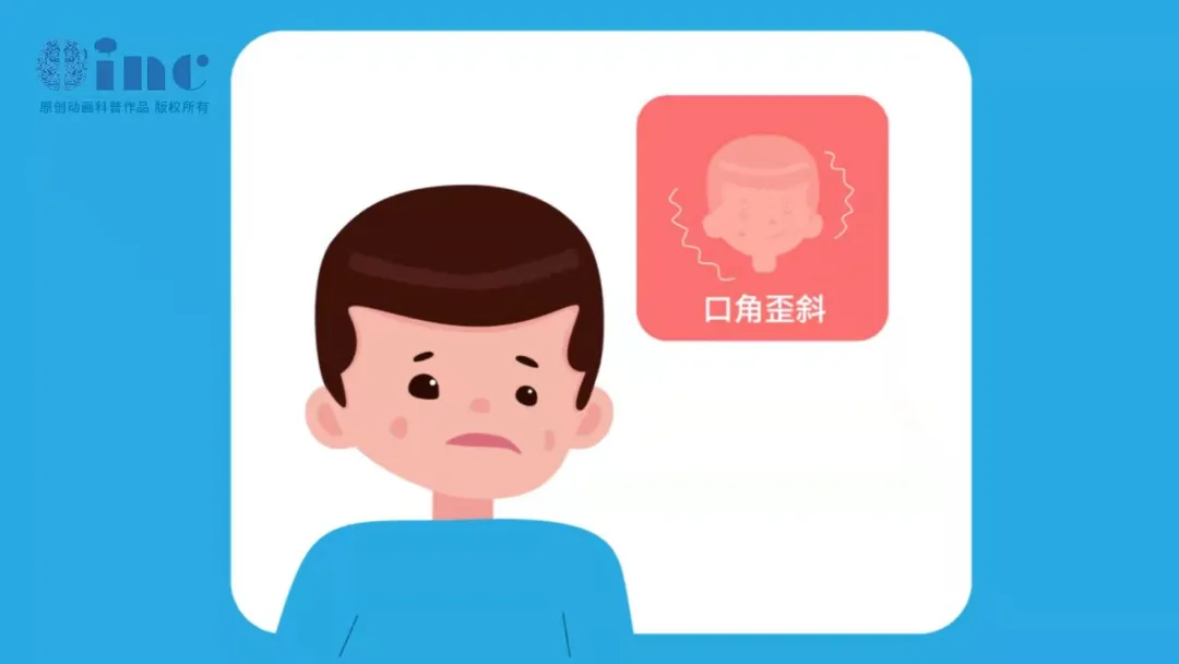 面神经鞘瘤由于肿瘤组织发展比较缓慢，因此进行性面瘫是大部分面神经鞘瘤患者的主要症状，但部分患者也可在短时间内出现面瘫，易被误诊为Bell面瘫。