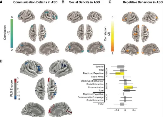 图 4 ASD 相关评分与 CMS+ 病灶体积连接性的关联 （A–C）全脑体素水平分析显示，CMS+ 病灶体积的连接性与 ASD 个体的沟通障碍、社交缺陷及重复行为相关。沟通障碍（A）和社交缺陷（B）越严重，相应连接性越低；而重复行为（C）越严重，连接性越高。 （D）ASD 评分与影像数据的多维关联分析揭示出一个显著潜在变量，提示沟通缺陷与 CMS+ 病灶体积至前额叶及顶叶皮质的连接性存在关联。
