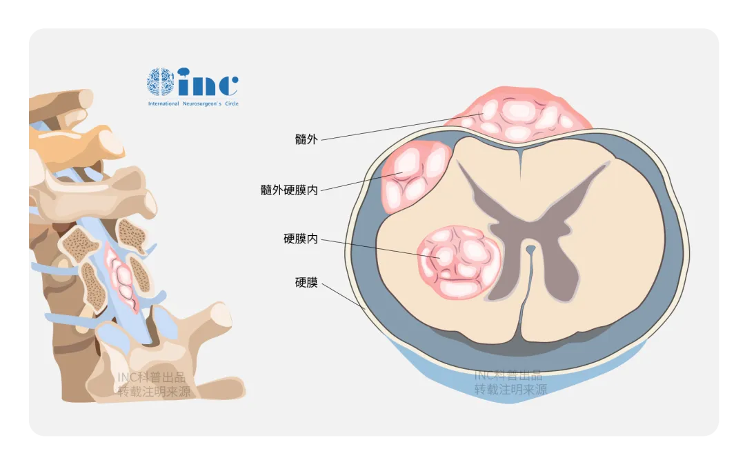 脊髓作为神经系统的重要组成部分，它的一切活动都受到大脑的控制，负责传递各种感觉，并调整肌张力、协调肌肉活动、维持姿势和习惯性动作，使动作协调、准确。