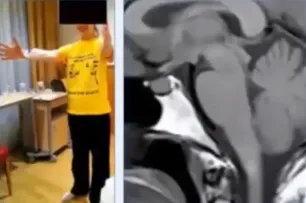- 手术成功 -  再次站立的感觉真好