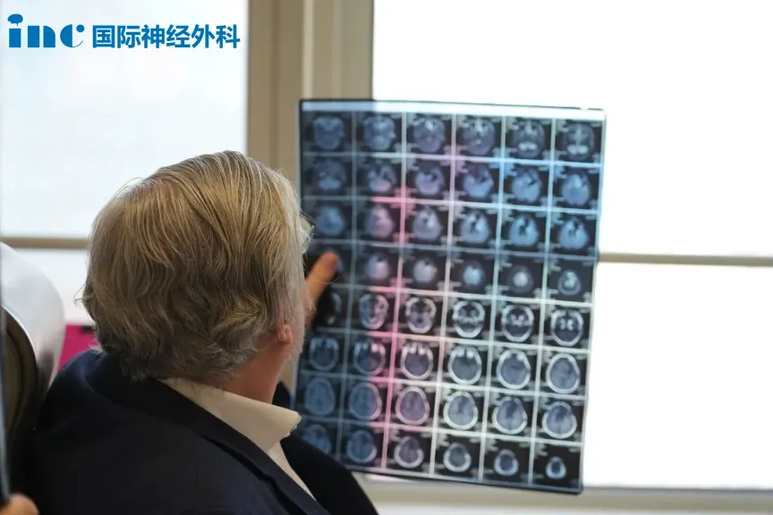 小欧母亲将希望寄托于二次手术。这一次，她找到看巴教授。巴教授认为开颅术后，小欧癫痫发作的频率将会变低，癫痫的治疗成功率超过80%。
