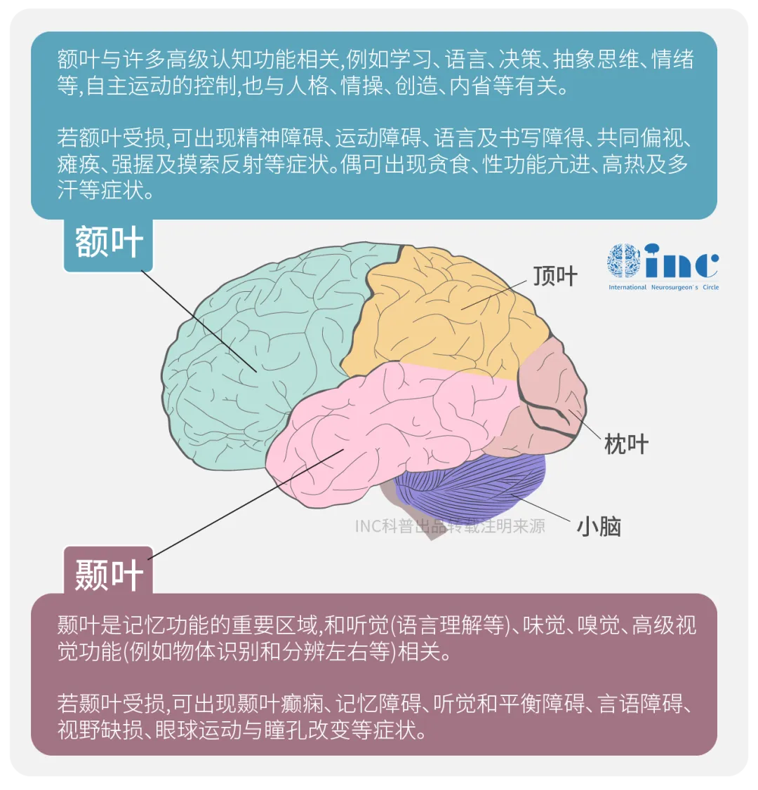 额叶与许多高级认知功能相关,例如学习、语言、决策、抽象思维、情绪等,自主运动的控制,也与人格、情操、创造、内省等有关。 若额叶受损,可出现精神障碍、运动障碍、语言及书写障得、共同偏视、瘫痪、强握及摸索反射等症状。偶可出现贪食、性功能亢进、高热及多汗等症状。 颞叶是记忆功能的重要区域,和听觉(语言理解等)、味觉、嗅觉、高级视觉功能(例如物体识别和分辨左右等)相关。 若颞叶受损,可出现颞叶<a href='/dianxian/' target='_blank'><u>癫痫</u></a>、记忆障碍、听觉和平衡障碍、言语障碍视野缺损、眼球运动与瞳孔改变等症状。
