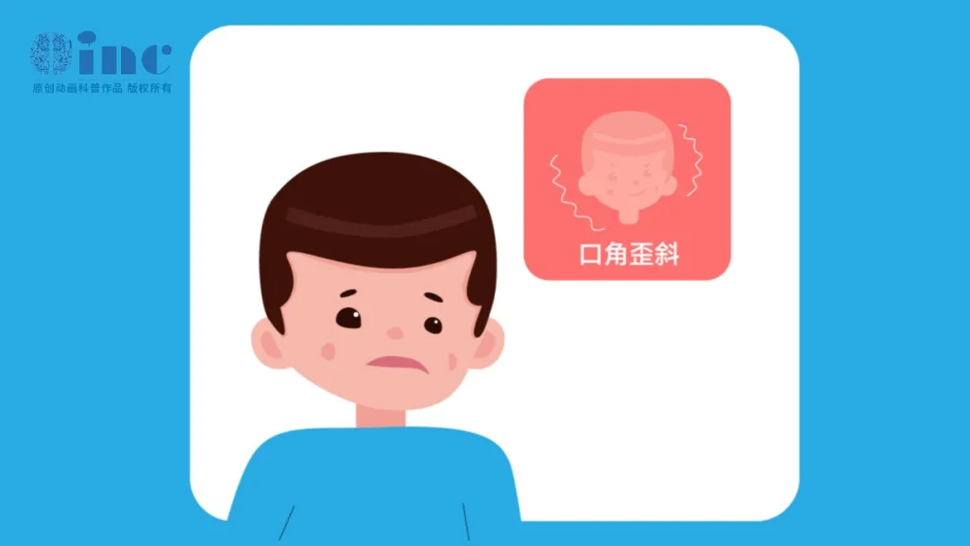其他颅神经损伤